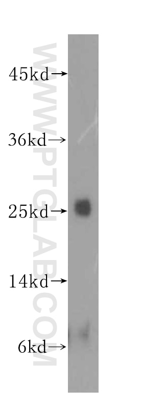 Western Blot (WB) analysis of HEK-293 cells using N6AMT2 Polyclonal antibody (16954-1-AP)