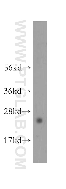 Western Blot (WB) analysis of mouse thymus tissue using N6AMT2 Polyclonal antibody (16954-1-AP)