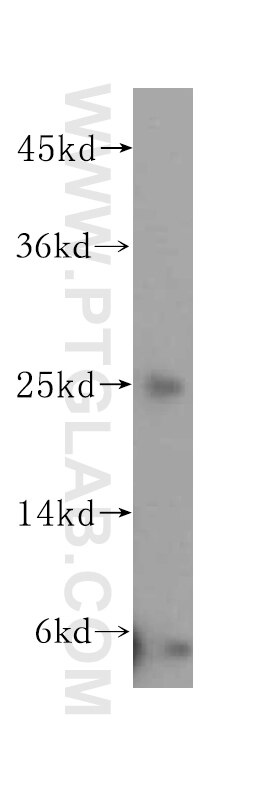 WB analysis of A431 using 16954-1-AP