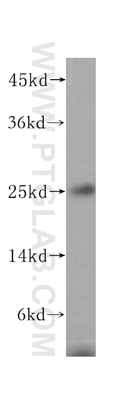 Western Blot (WB) analysis of human liver tissue using N6AMT2 Polyclonal antibody (16954-1-AP)