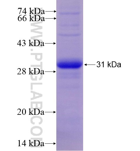 N6AMT2 fusion protein Ag11009 SDS-PAGE