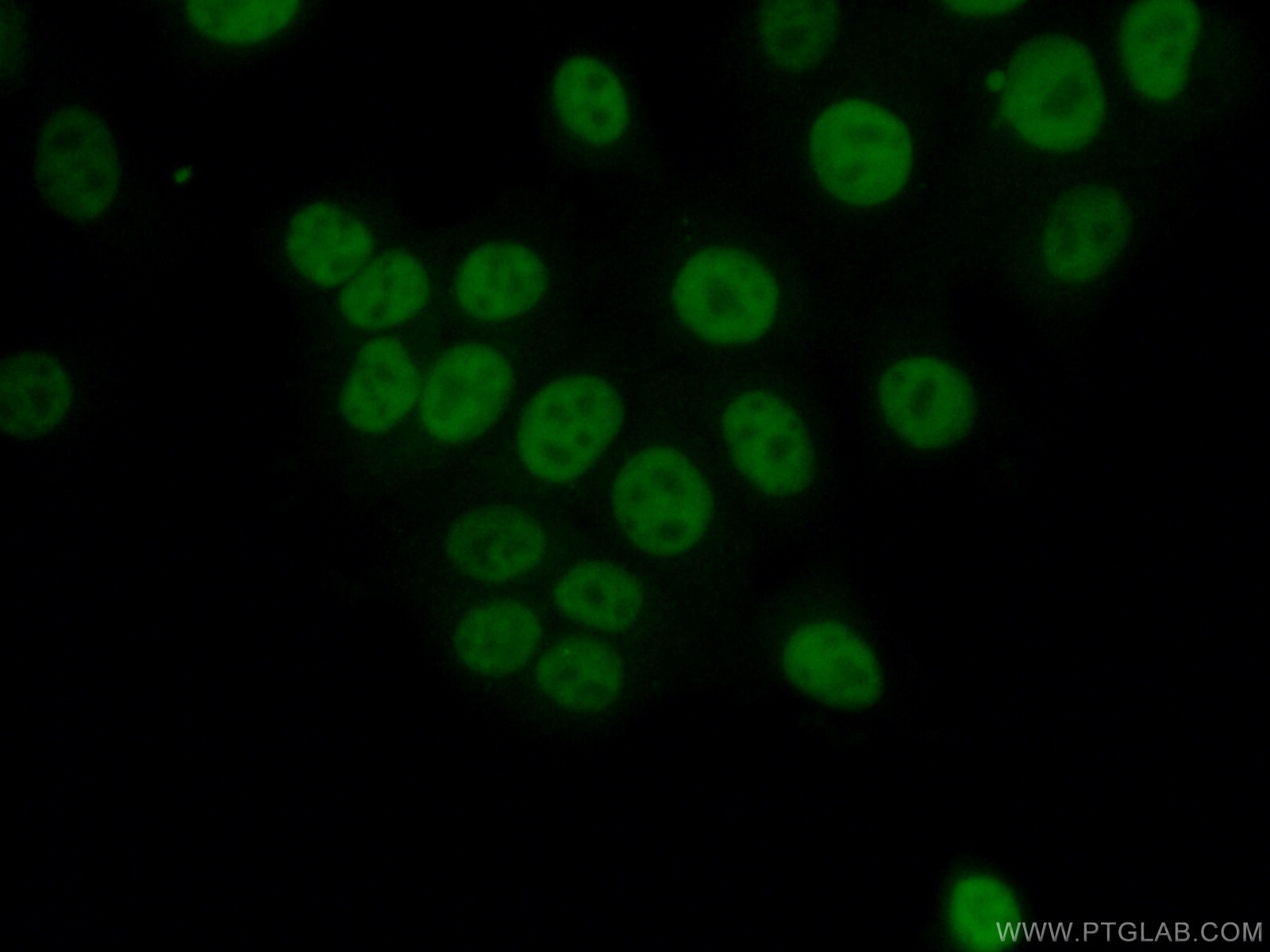 Immunofluorescence (IF) / fluorescent staining of MCF-7 cells using NAB2 Polyclonal antibody (19601-1-AP)