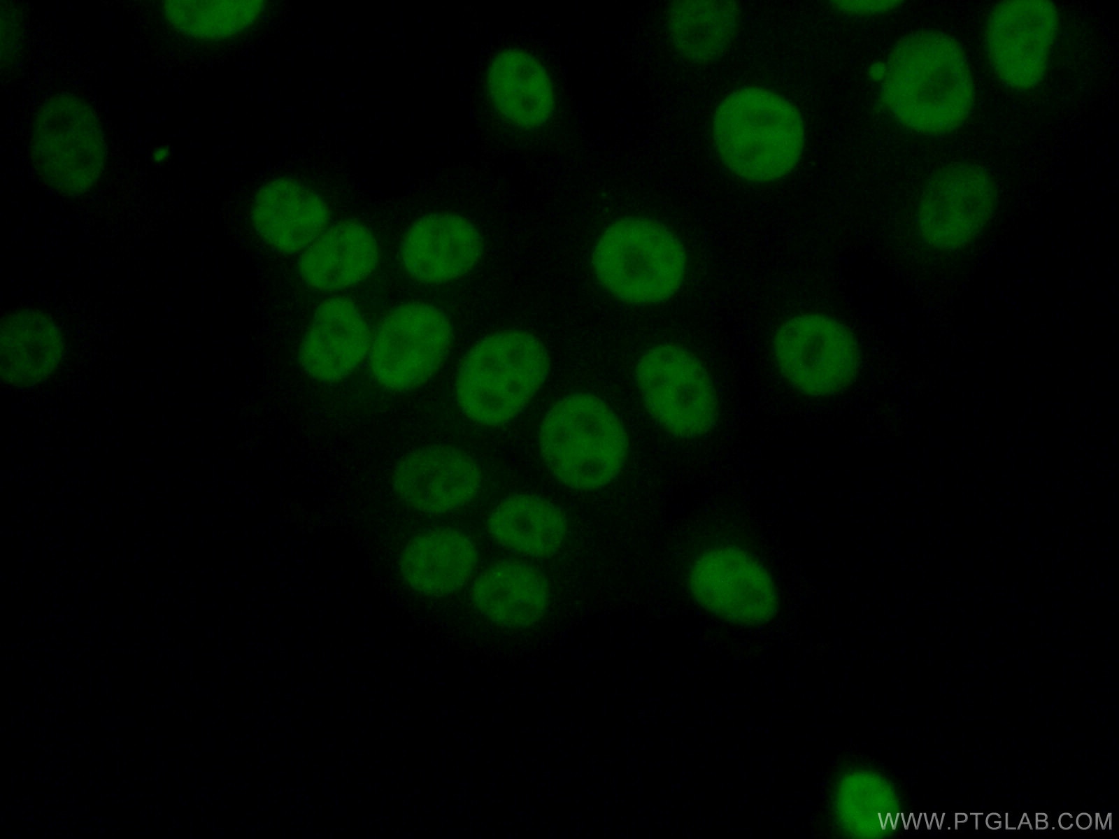 IF Staining of MCF-7 using 19601-1-AP