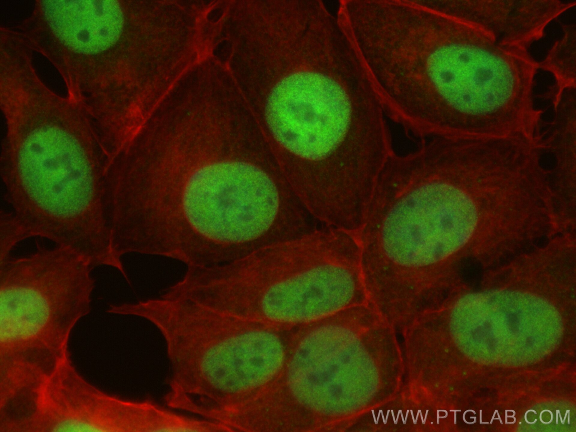 Immunofluorescence (IF) / fluorescent staining of MCF-7 cells using NAB2 Polyclonal antibody (19601-1-AP)