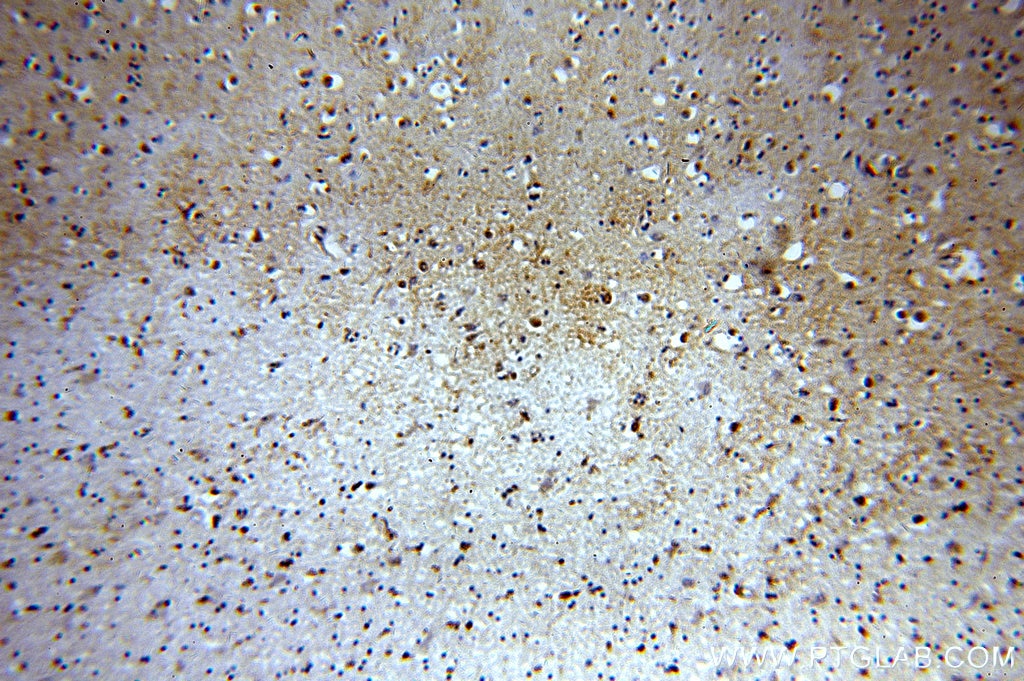 IHC staining of human brain using 19601-1-AP