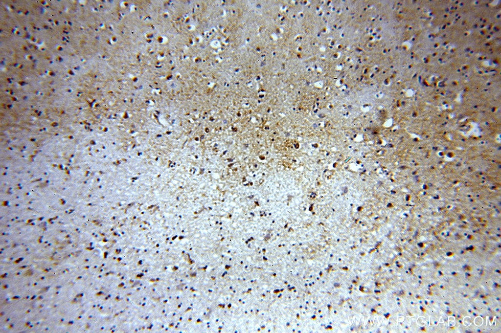 Immunohistochemistry (IHC) staining of human brain tissue using NAB2 Polyclonal antibody (19601-1-AP)