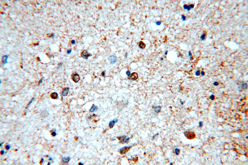 Immunohistochemistry (IHC) staining of human brain tissue using NAB2 Polyclonal antibody (19601-1-AP)