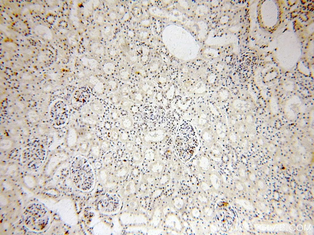 Immunohistochemistry (IHC) staining of human kidney tissue using NAB2 Polyclonal antibody (19601-1-AP)