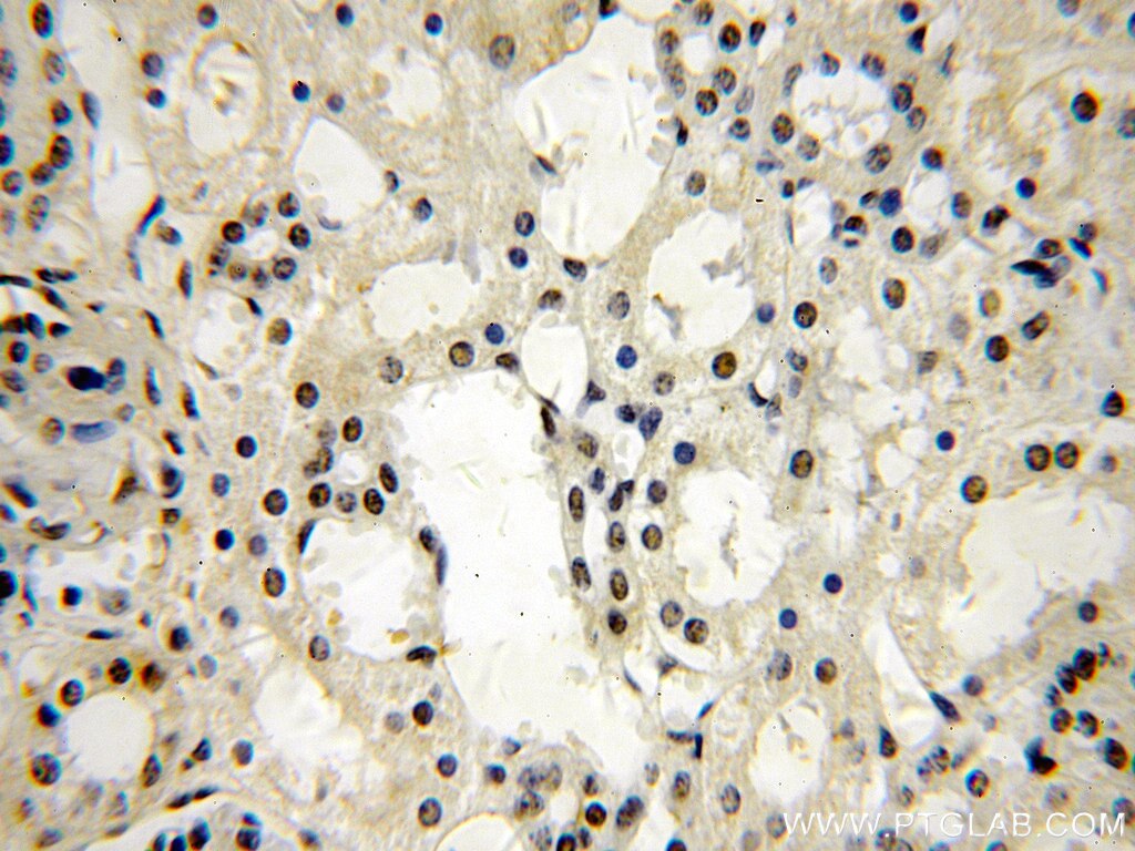 Immunohistochemistry (IHC) staining of human kidney tissue using NAB2 Polyclonal antibody (19601-1-AP)