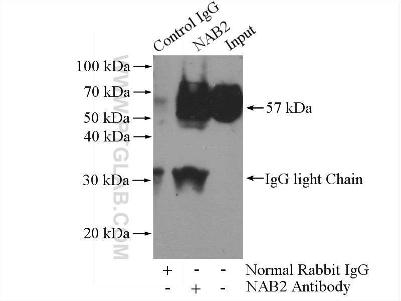 Immunoprecipitation (IP) experiment of K-562 cells using NAB2 Polyclonal antibody (19601-1-AP)