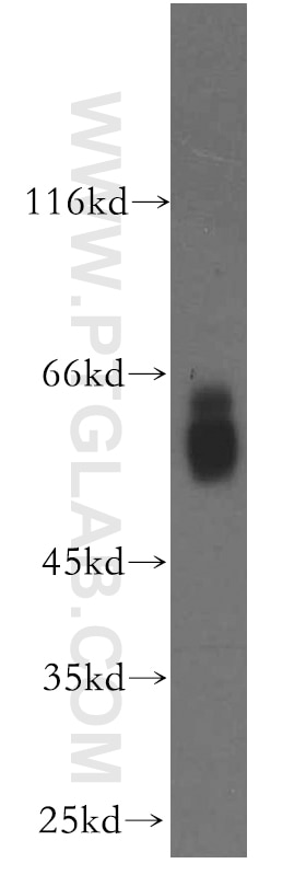 Western Blot (WB) analysis of human brain tissue using NAB2 Polyclonal antibody (19601-1-AP)