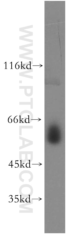 Western Blot (WB) analysis of K-562 cells using NAB2 Polyclonal antibody (19601-1-AP)