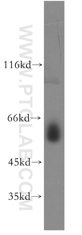 WB analysis of K-562 using 19601-1-AP