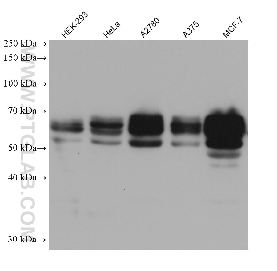 Western Blot (WB) analysis of various lysates using NAB2 Monoclonal antibody (68322-1-Ig)