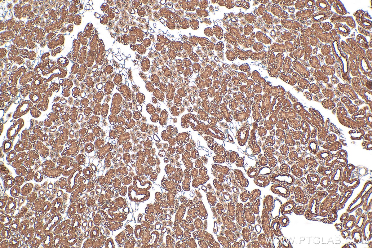Immunohistochemistry (IHC) staining of mouse kidney tissue using NACA Polyclonal antibody (32235-1-AP)