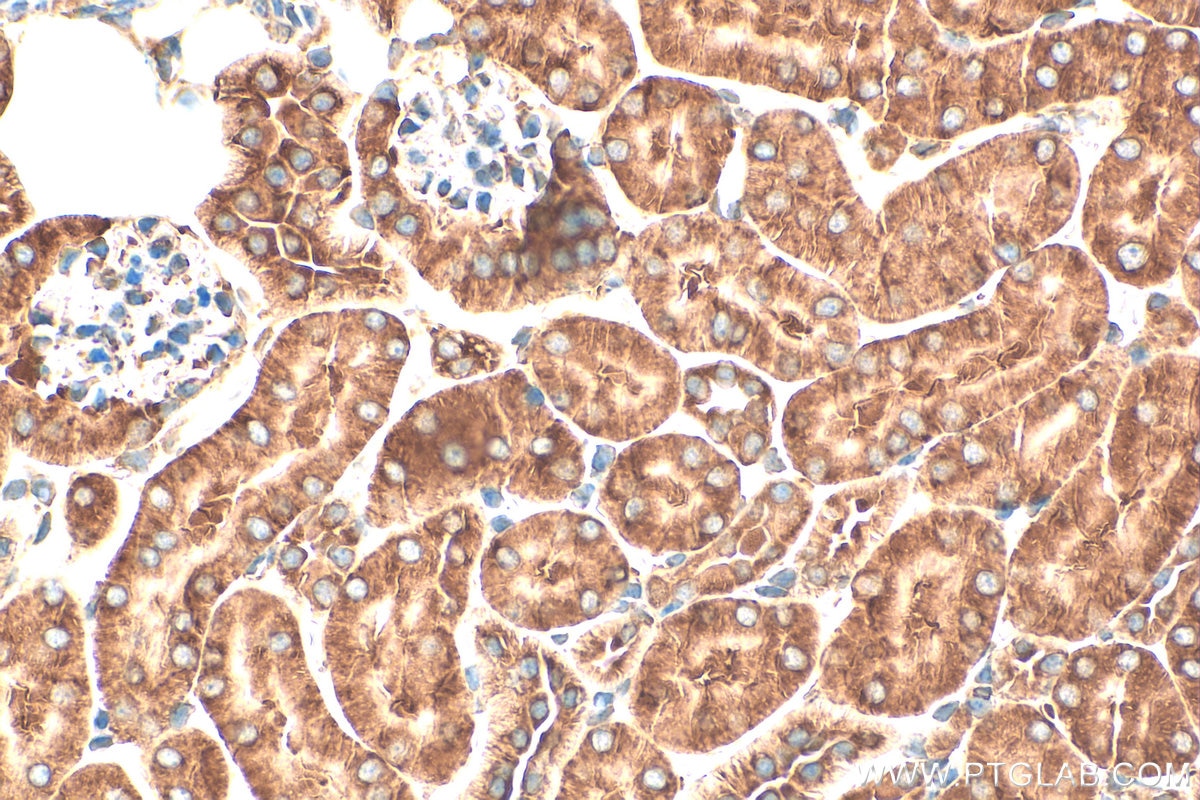 Immunohistochemistry (IHC) staining of mouse kidney tissue using NACA Polyclonal antibody (32235-1-AP)
