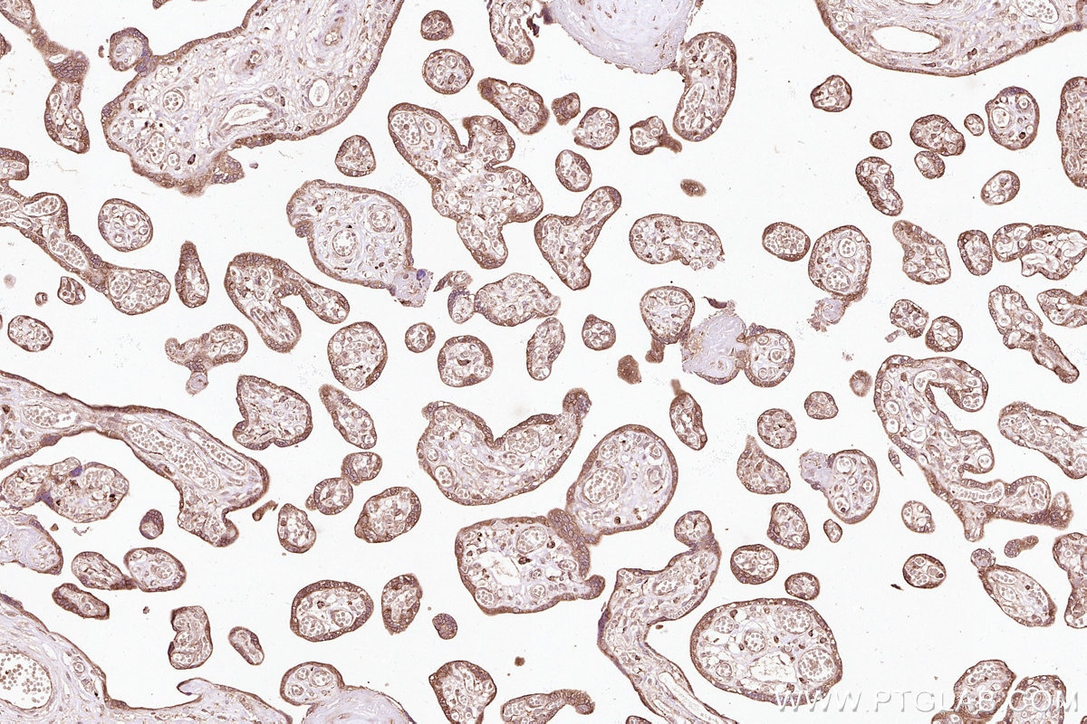 IHC staining of human placenta using 32235-1-AP Immunohistochemistry (IHC) staining of human placenta tissue using NACA Polyclonal antibody (32235-1-AP)