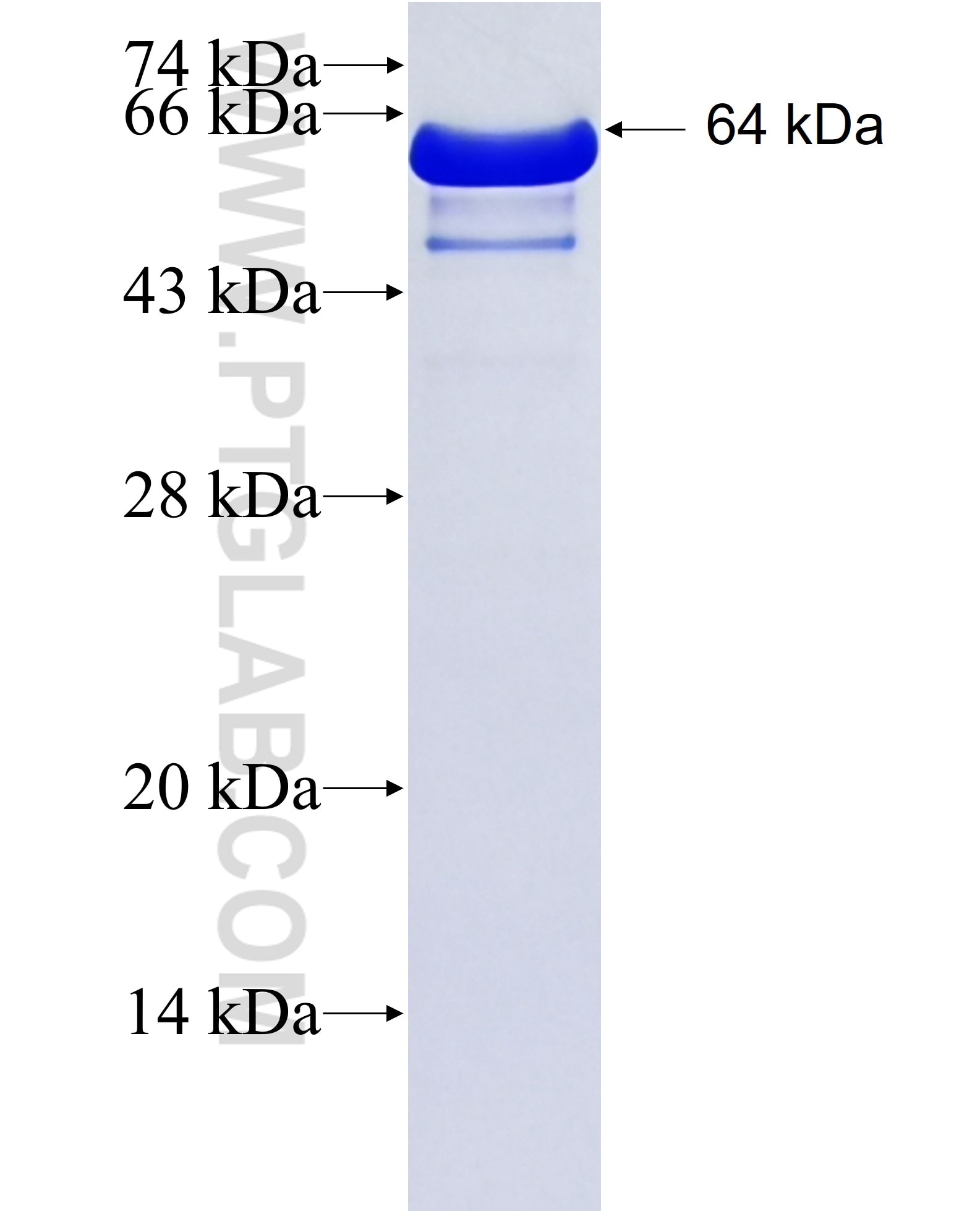 NACA fusion protein Ag37704 SDS-PAGE