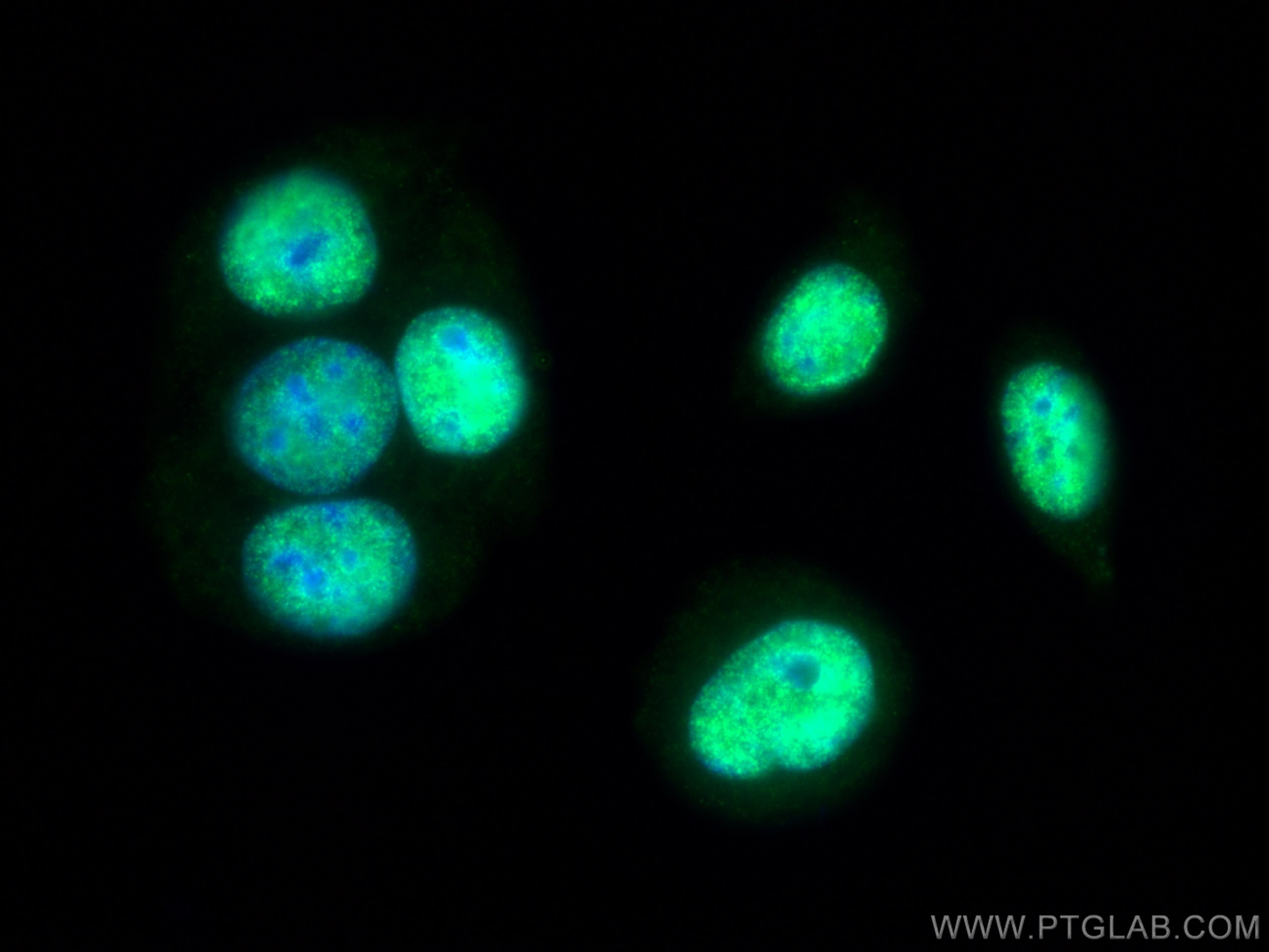 Immunofluorescence (IF) / fluorescent staining of MCF-7 cells using NACC1 Polyclonal antibody (14551-1-AP)