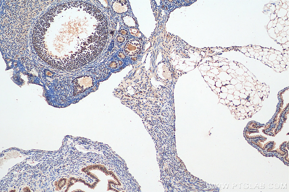 Immunohistochemistry (IHC) staining of mouse ovary tissue using NACC1 Polyclonal antibody (14551-1-AP)