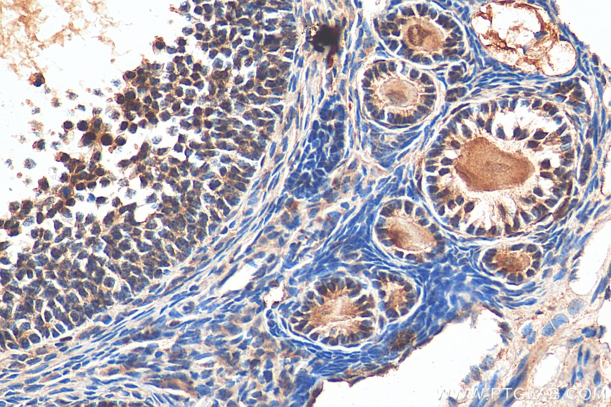 Immunohistochemistry (IHC) staining of mouse ovary tissue using NACC1 Polyclonal antibody (14551-1-AP)