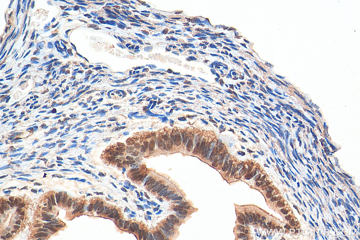 IHC staining of mouse ovary using 14551-1-AP