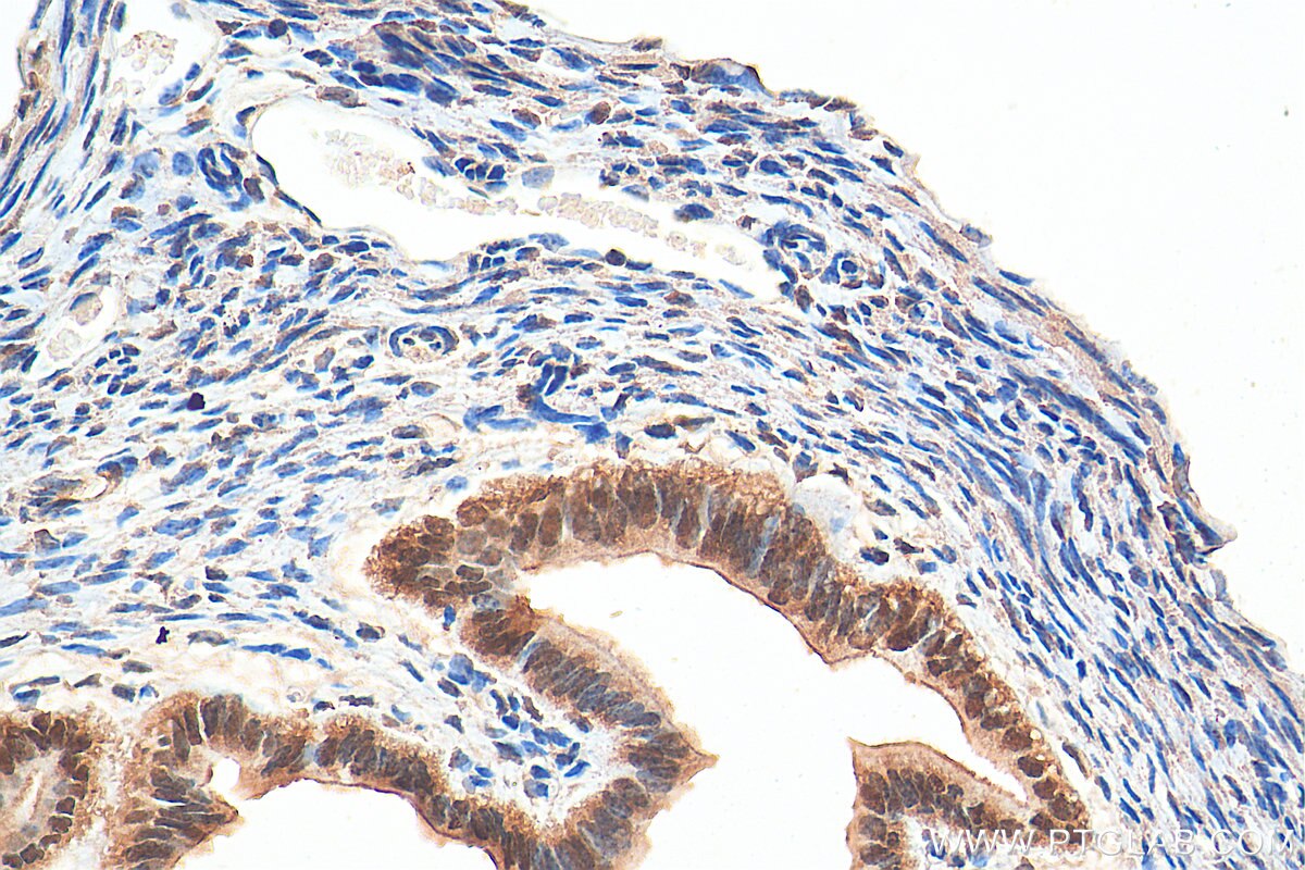 Immunohistochemistry (IHC) staining of mouse ovary tissue using NACC1 Polyclonal antibody (14551-1-AP)