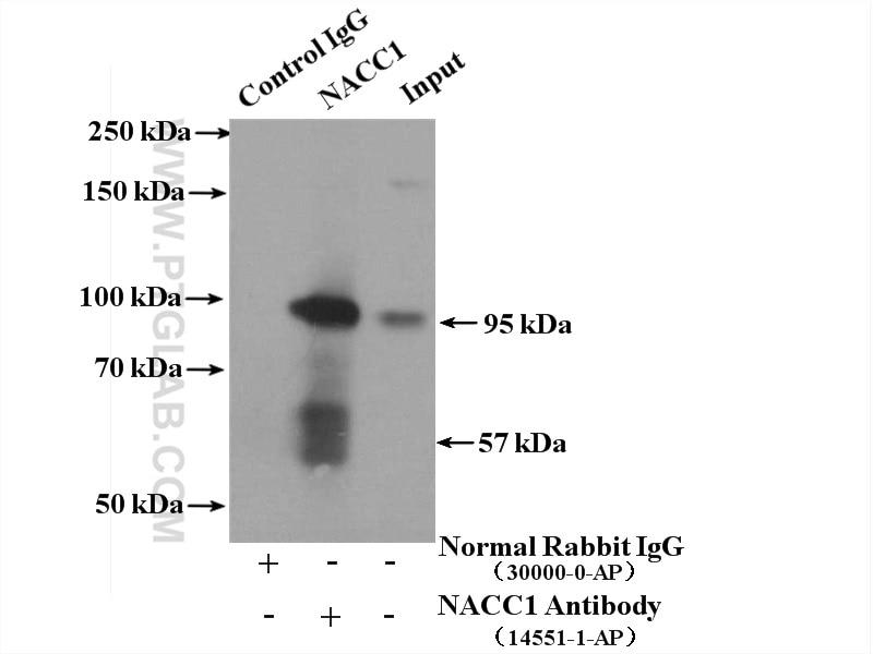 Immunoprecipitation (IP) experiment of MCF-7 cells using NACC1 Polyclonal antibody (14551-1-AP)