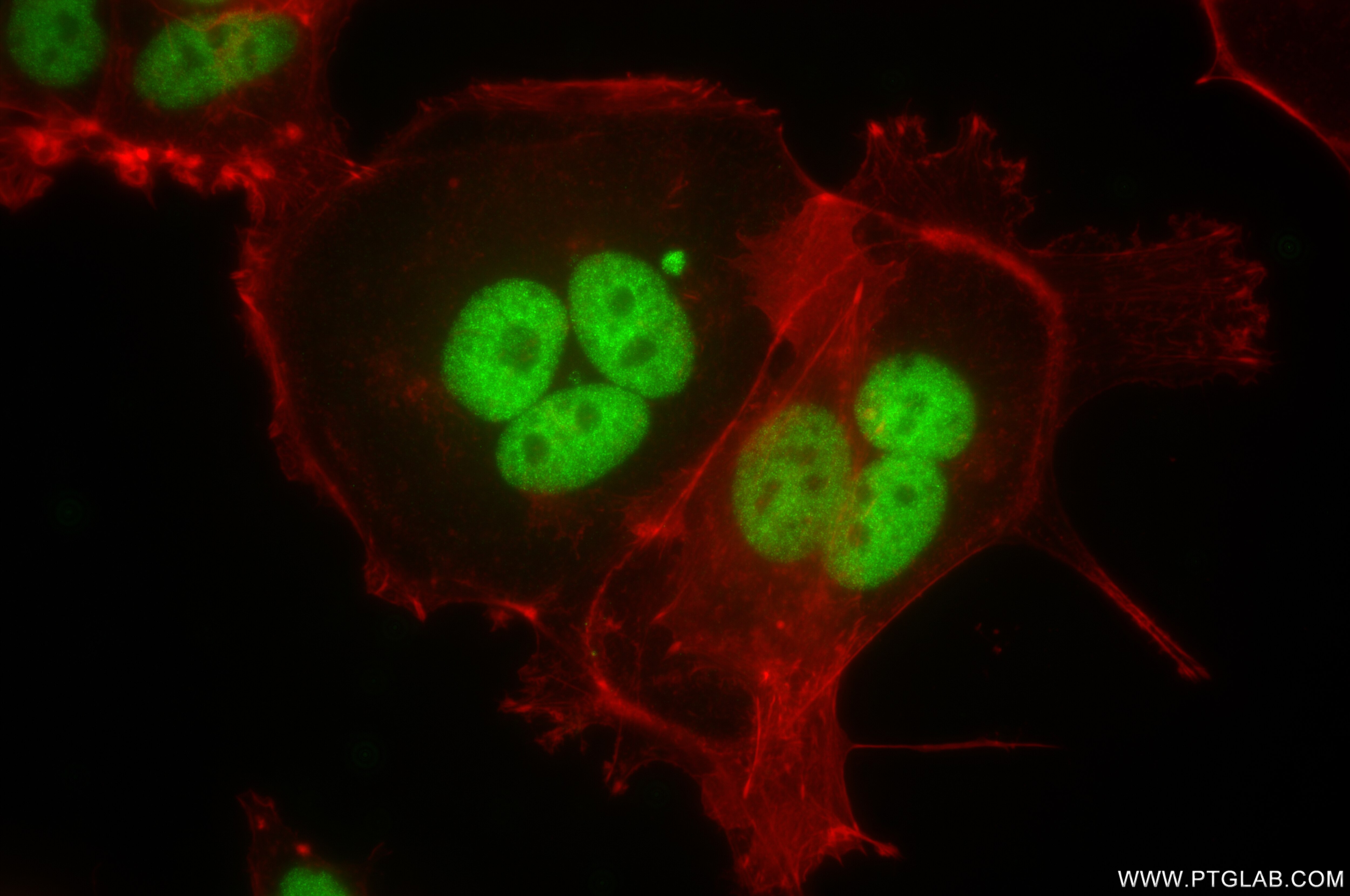 Immunofluorescence (IF) / fluorescent staining of MCF-7 cells using NAC1 Recombinant antibody (85380-2-RR)