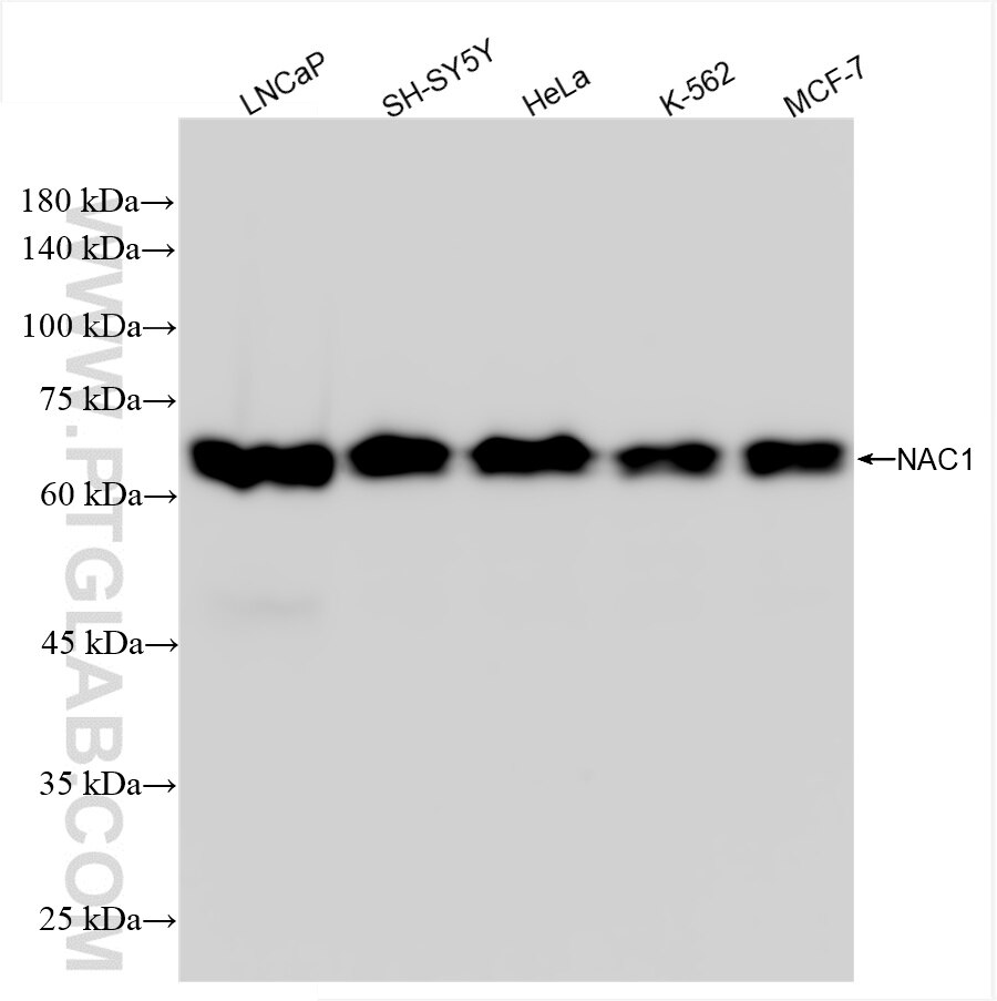 Western Blot (WB) analysis of various lysates using NAC1 Recombinant antibody (85380-2-RR)