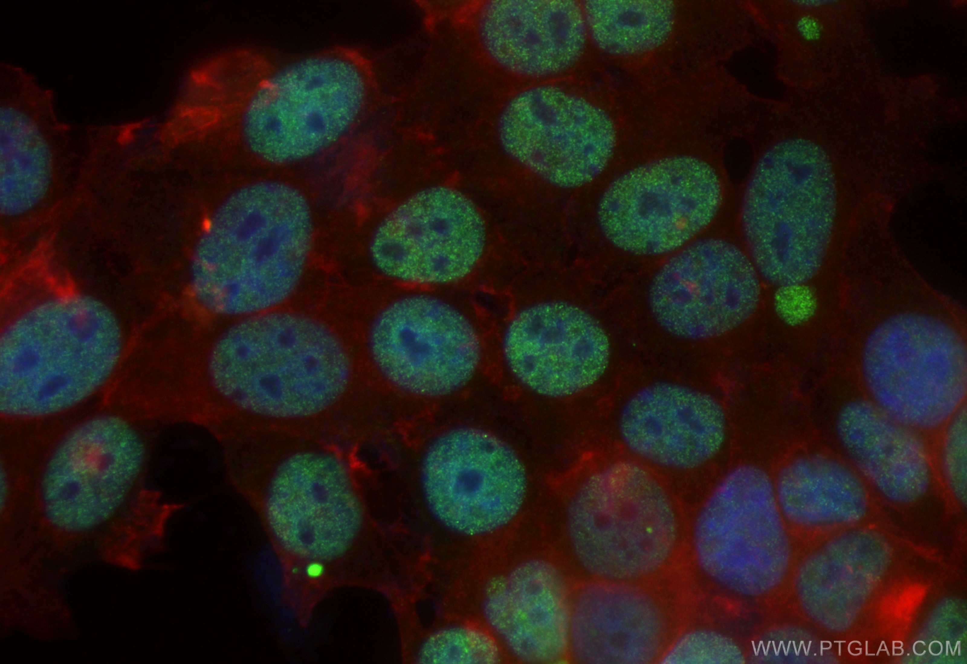 Immunofluorescence (IF) / fluorescent staining of MCF-7 cells using CoraLite® Plus 488-conjugated NAC1 Polyclonal anti (CL488-14551)