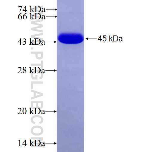 NACC1 fusion protein Ag6468 SDS-PAGE