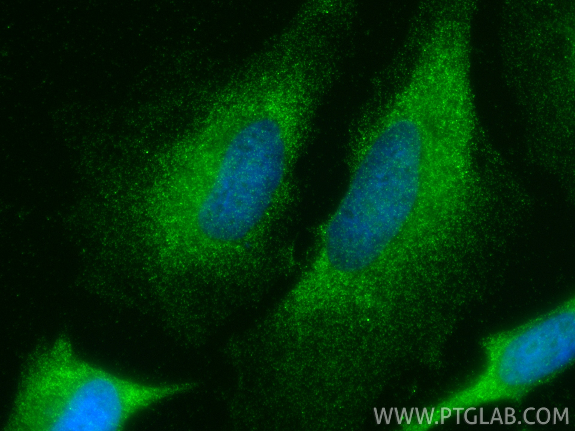Immunofluorescence (IF) / fluorescent staining of HeLa cells using NADK Polyclonal antibody (15548-1-AP)
