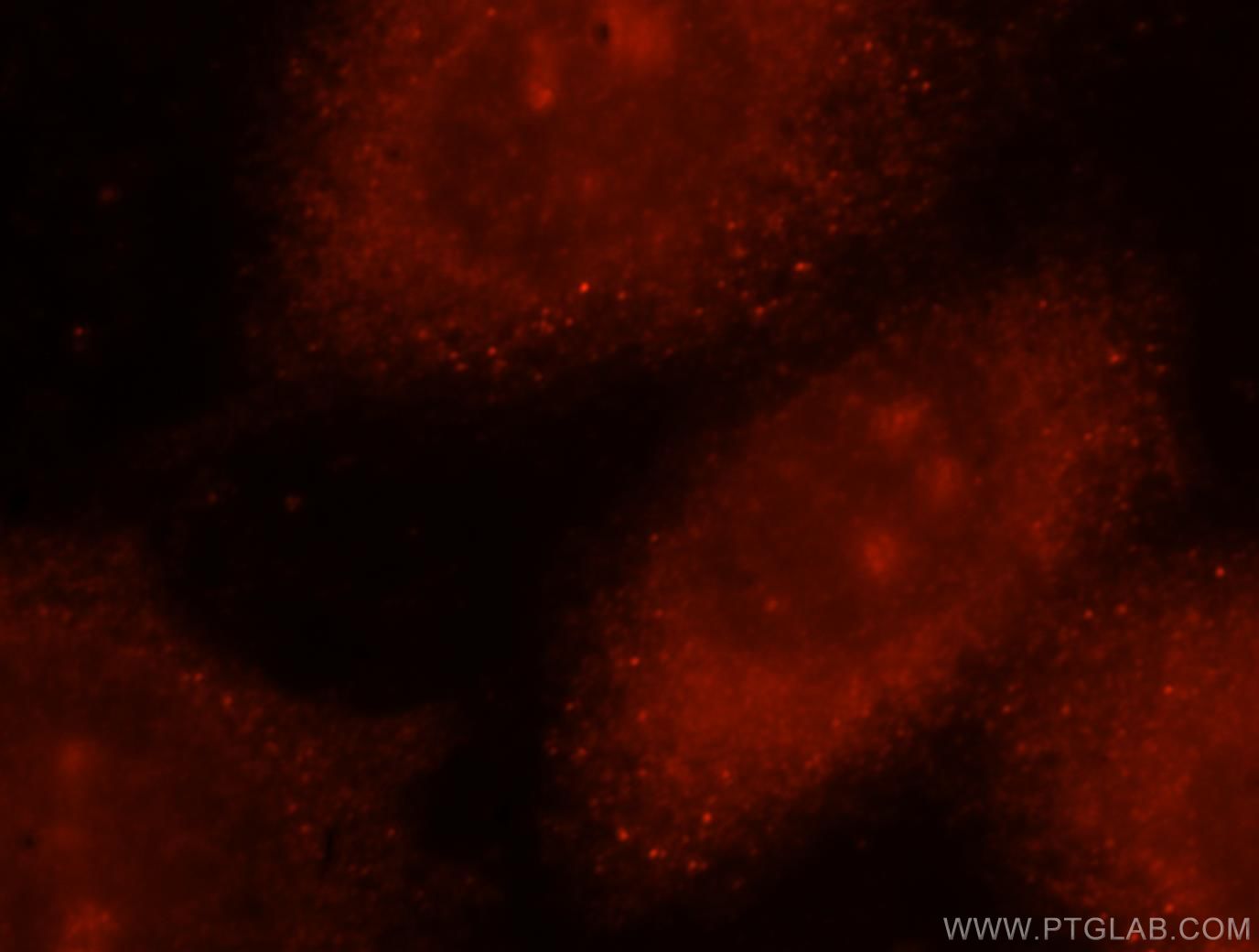 Immunofluorescence (IF) / fluorescent staining of HeLa cells using NADK Polyclonal antibody (15548-1-AP)