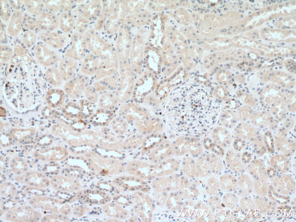 Immunohistochemistry (IHC) staining of human kidney tissue using NADK Polyclonal antibody (15548-1-AP)