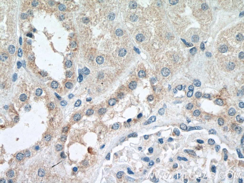 Immunohistochemistry (IHC) staining of human kidney tissue using NADK Polyclonal antibody (15548-1-AP)