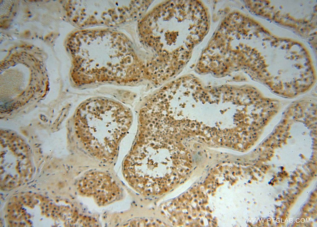 Immunohistochemistry (IHC) staining of human testis tissue using NADK Polyclonal antibody (15548-1-AP)