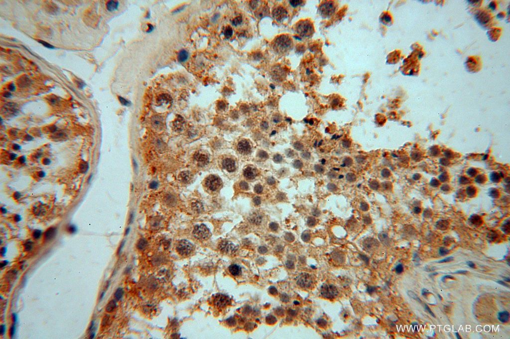 Immunohistochemistry (IHC) staining of human testis tissue using NADK Polyclonal antibody (15548-1-AP)