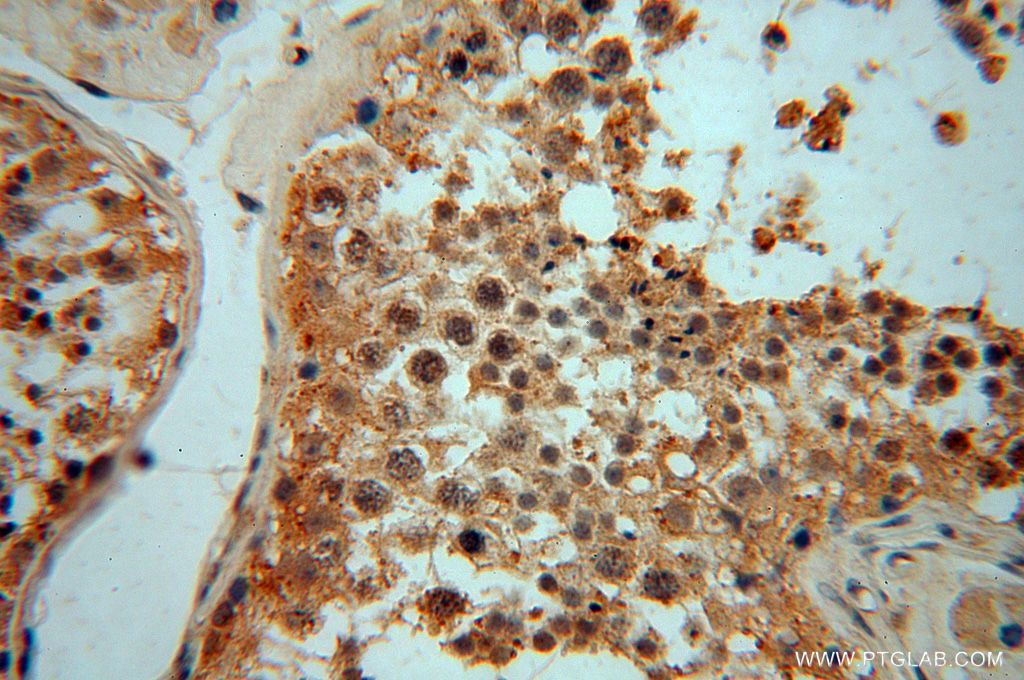 IHC staining of human testis using 15548-1-AP