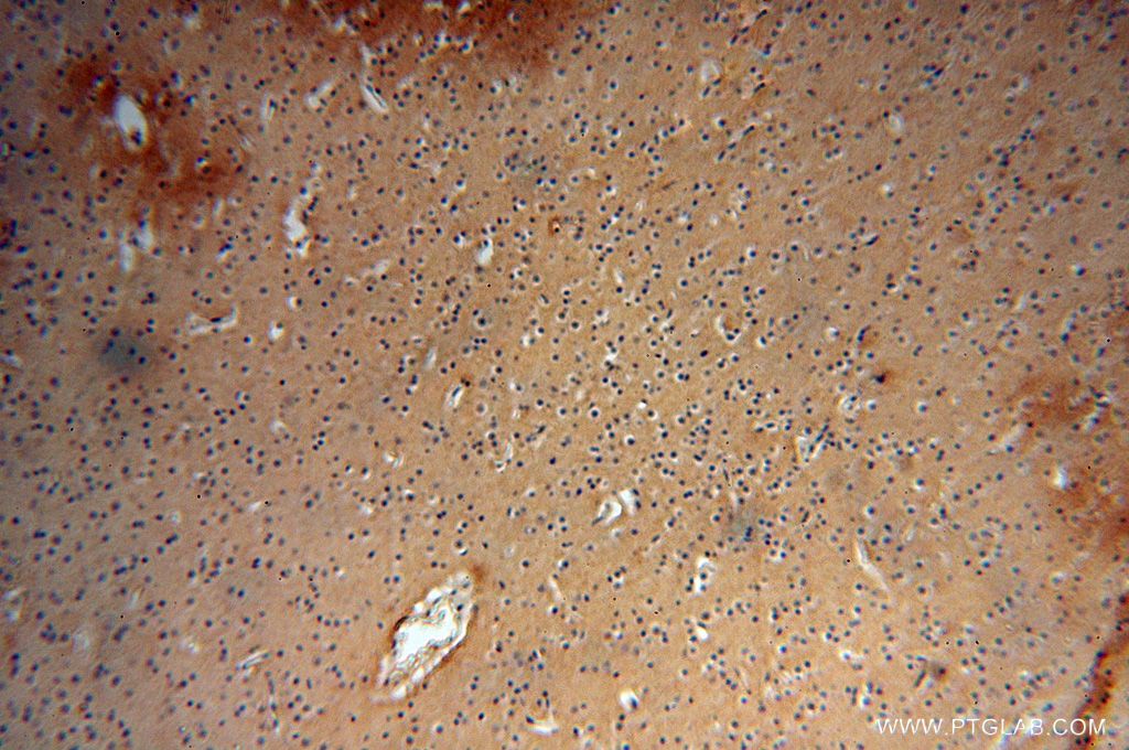 Immunohistochemistry (IHC) staining of human brain tissue using NADK Polyclonal antibody (15548-1-AP)