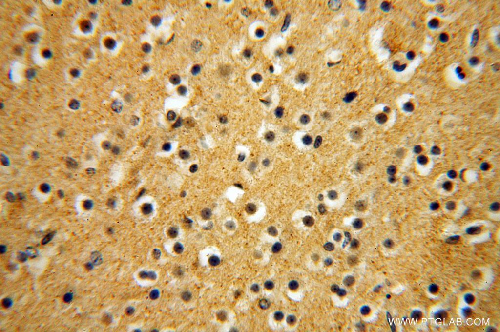 IHC staining of human brain using 15548-1-AP