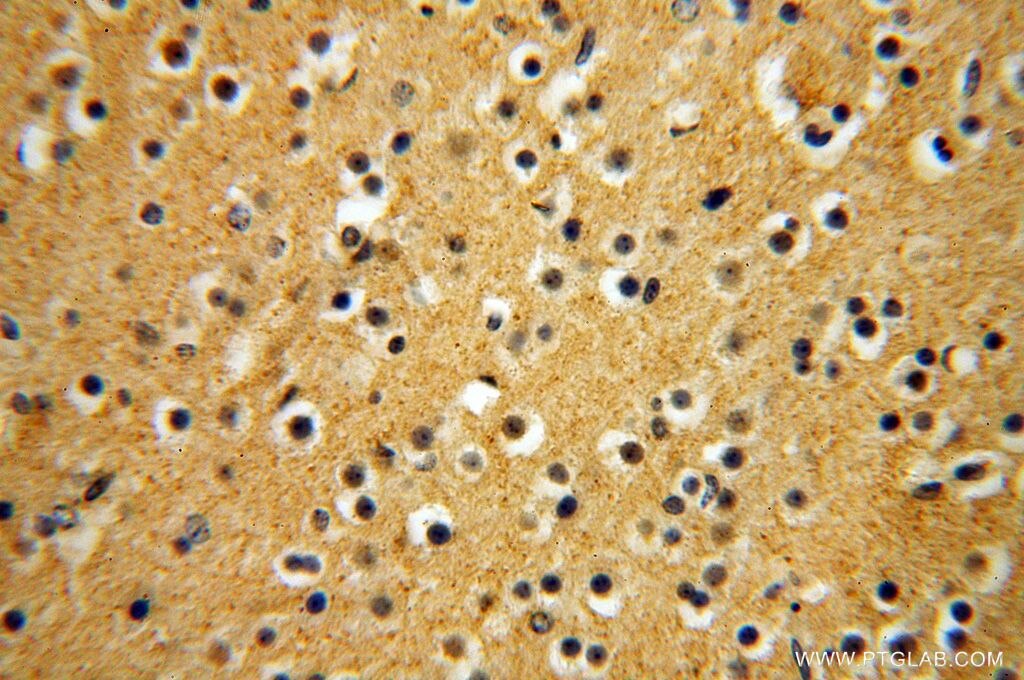 IHC staining of human brain using 15548-1-AP