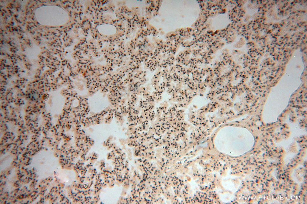Immunohistochemistry (IHC) staining of human lung tissue using NADK Polyclonal antibody (15548-1-AP)