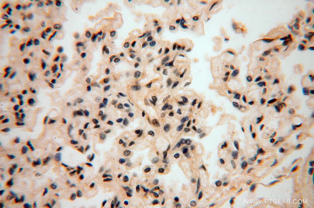 Immunohistochemistry (IHC) staining of human lung tissue using NADK Polyclonal antibody (15548-1-AP)