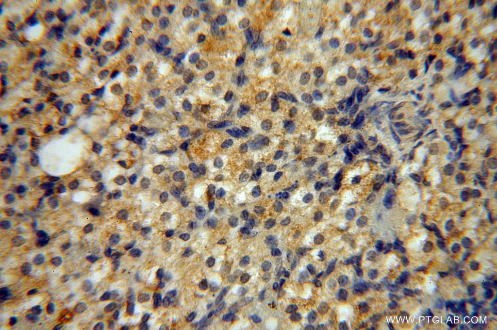 Immunohistochemistry (IHC) staining of human ovary tissue using NADK Polyclonal antibody (15548-1-AP)