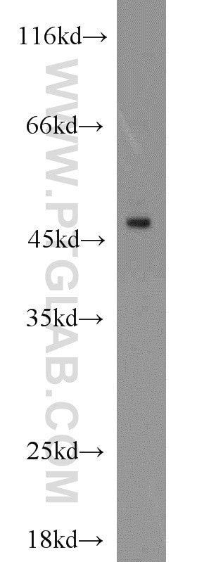 Western Blot (WB) analysis of RAW264.7 using NADK Polyclonal antibody (15548-1-AP)