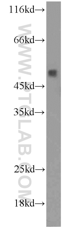 Western Blot (WB) analysis of NIH/3T3 cells using NADK Polyclonal antibody (15548-1-AP)