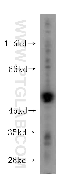 Western Blot (WB) analysis of HeLa cells using NADK Polyclonal antibody (15548-1-AP)