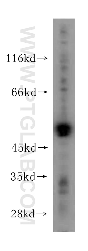 WB analysis of HeLa using 15548-1-AP