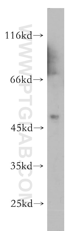 Western Blot (WB) analysis of HeLa cells using NADK Polyclonal antibody (15548-1-AP)